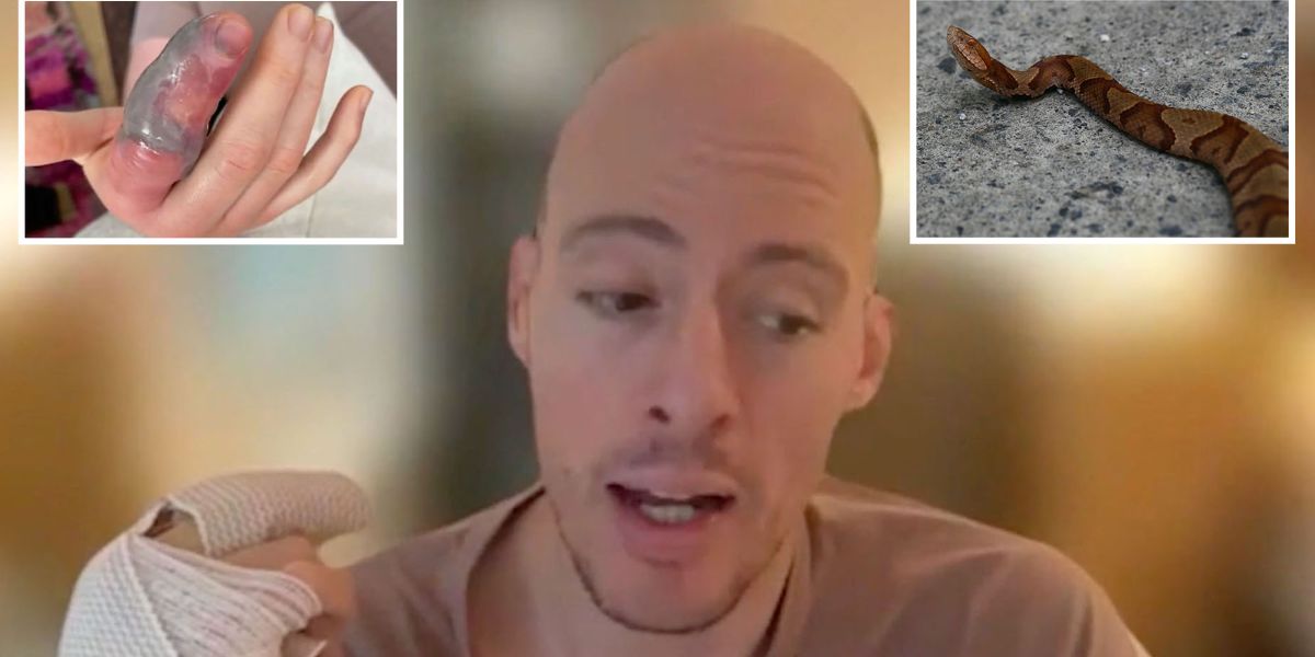 NYC Cyclist’s Good Deed Goes Wrong Venomous Snake Bite Leads to Gruesome Injury